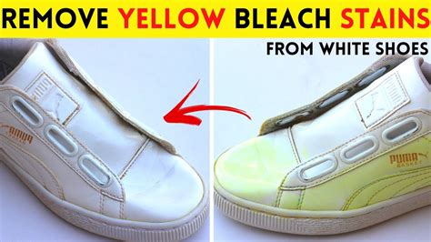 bleached white shoes turned yellow.